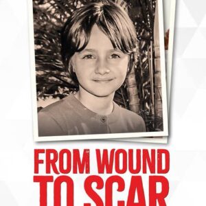 From Wound to Scar